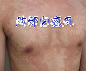 u=2220537900,128876546&fm=27&gp=0.jpg